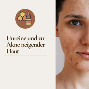 Propolis bei Akne, Propolis bei unreiner Haut